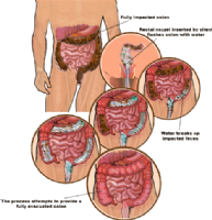 COLONIC INSTITUTE.COM Photo